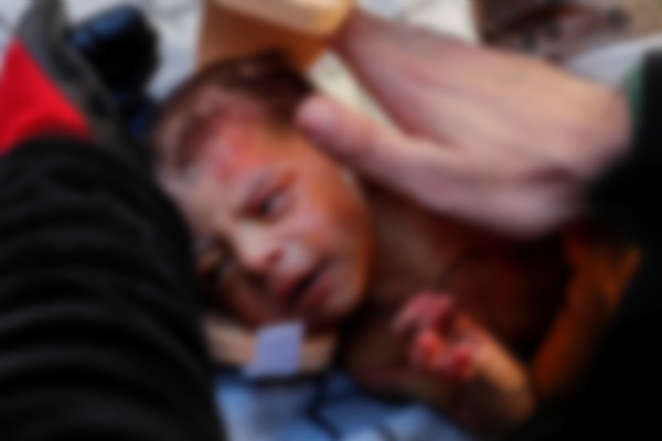 Mucizenin adı 20 günlük Kerem bebek